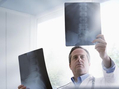 Doctor studying x-rays